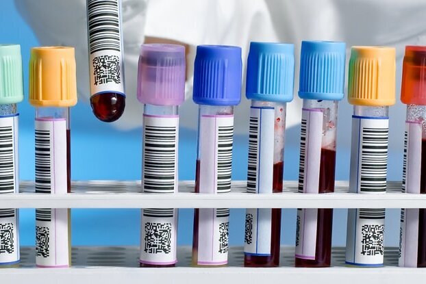 Plusieurs tubes à essai avec des étiquettes à code-barres, dans un plateau, motif d'image pour collage rond, format paysage.